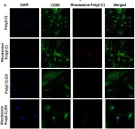 Fig.4.B showing Immunocytochemistry-immunofluorescence from the publication: TLR3 Ligand Poly(I:C) Exerts Distinct Actions in Synovial Fibroblasts When Delivered by Extracellular Vesicles.