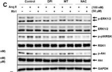 Phospho-p90RSK (Ser380) (D5D8) Rabbit Monoclonal Antibody | Cell