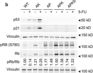 Fig.3.B showing Western Blotting from the publication: Rewiring glucose metabolism improves 5-FU efficacy in p53-deficient/KRASG12D glycolytic colorectal tumors.