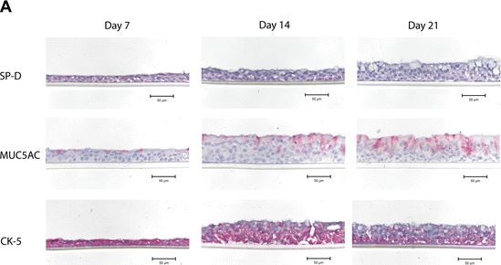 Fig.3.A showing Immunohistochemistry in a Homo sapiens (Human) sample from the publication: Expression of surfactant protein D in airways of asthmatics and interleukin-13 modulation of surfactant protein D in human models of airway epithelium.