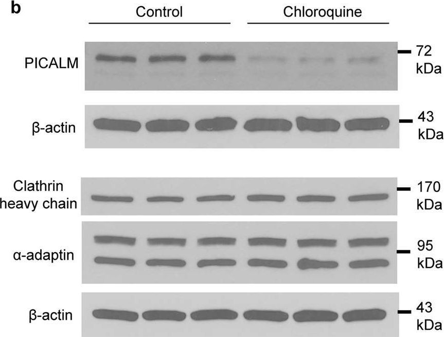 Fig.4.B showing Western Blotting in a Rattus norvegicus (Rat) sample from the publication: A chloroquine-induced macrophage-preconditioning strategy for improved nanodelivery.