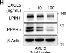 Fig.5.H showing Western Blotting from the publication: CXCL6 exacerbates metabolic dysfunction-associated steatohepatitis by suppressing LPIN1-mediated fatty acid oxidation in hepatocytes.