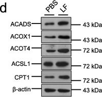 Fig.6.D showing Western Blotting from the publication: Lactobacillus frumenti mediates energy production via fatty acid β-oxidation in the liver of early-weaned piglets.