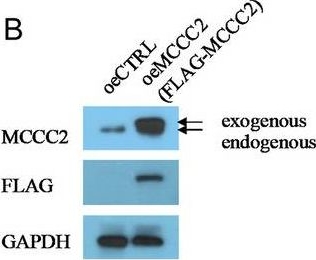 Fig.1.B showing Western Blotting in a Homo sapiens (Human) sample from the publication: MCCC2 is a novel mediator between mitochondria and telomere and functions as an oncogene in colorectal cancer.