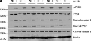 t@kページ Poly4064_AF555_IgG_Antibody_IF