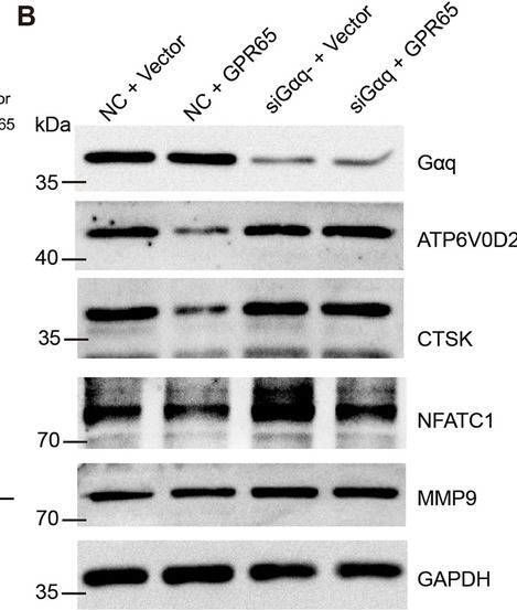 Fig.6.B showing Western Blotting from the publication: GPR65 Functions as a Key Factor of Bone Aging and a Novel Therapeutic Target for Osteoporosis.