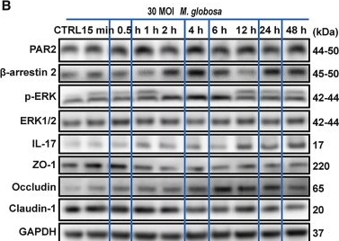 Fig.2.B showing Western Blotting from the publication: PAR2-β-arrestin 2-ERK axis mediates Malassezia globosa-induced IL-17 response by disrupting ZO-1 in keratinocytes.