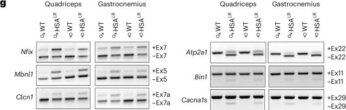 Fig.4.G showing Western Blotting from the publication: Use of HSALR female mice as a model for the study of myotonic dystrophy type I.