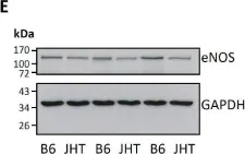 Fig.1.E showing Western Blotting from the publication: B Lymphocyte-Deficiency in Mice Causes Vascular Dysfunction by Inducing Neutrophilia.