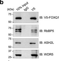 Fig.1.B showing Western Blotting from the publication: FOXQ1 recruits the MLL complex to activate transcription of EMT and promote breast cancer metastasis.