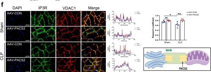 Fig.4.F showing Immunohistochemistry-immunofluorescence in a Mus musculus (House mouse) sample from the publication: PACS2 Alleviates Sepsis-Induced Myopathy by Activating ERK-MAPK Signalling Pathway to Suppress ER-Phagy.