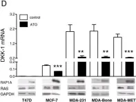 Fig.1.D showing Western Blotting from the publication: Dickkopf-1 is regulated by the mevalonate pathway in breast cancer.