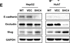 Fig.3.E showing Western Blotting from the publication: SHC4 promotes tumor proliferation and metastasis by activating STAT3 signaling in hepatocellular carcinoma.