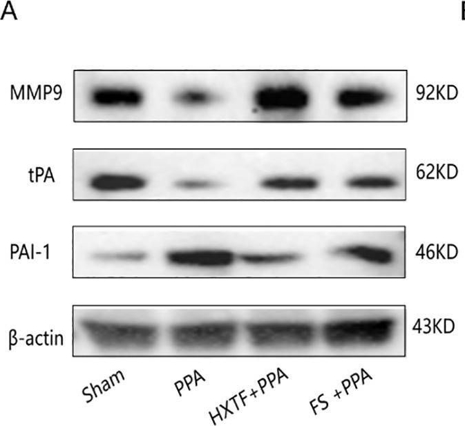 Fig.7.A showing Western Blotting in a Mus musculus (House mouse) sample from the publication: Herbal HuoXueTongFu Formula with anti-inflammatory and fibrinolytic activity regulation for the prevention of postoperative peritoneal adhesions.