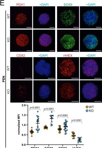 Fig.2.E showing Immunocytochemistry-immunofluorescence in a Homo sapiens (Human) sample from the publication: Oxidative stress and GPX2 control pancreatic vs. non-pancreatic cell fate in human endoderm.