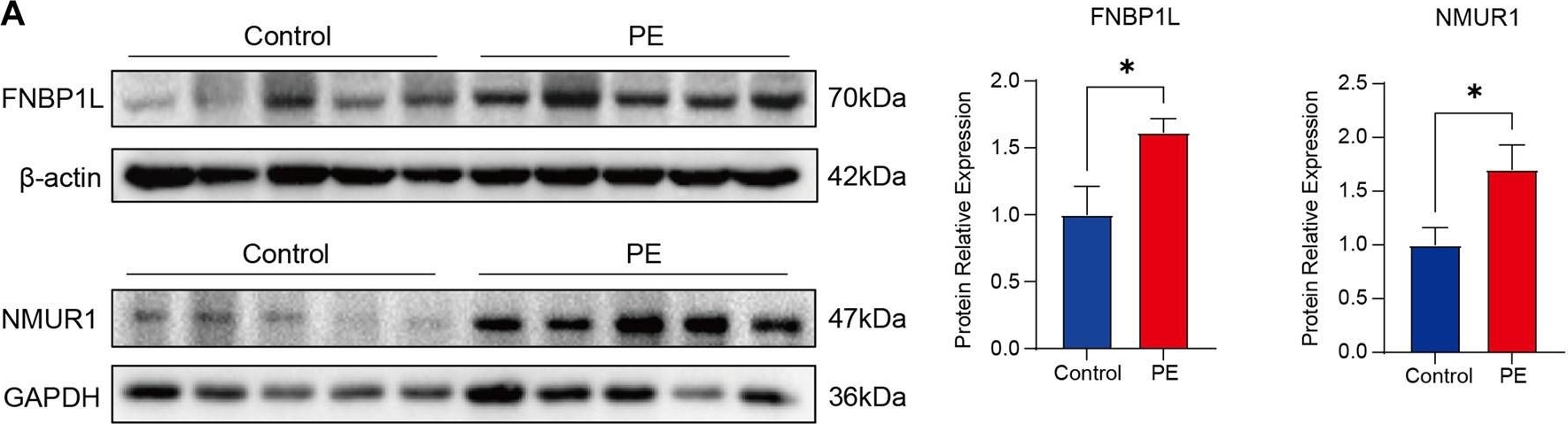 Fig.12.A showing Western Blotting in a Homo sapiens (Human) sample from the publication: Mechanistic study of pre-eclampsia and macrophage-associated molecular networks: bioinformatics insights from multiple datasets.