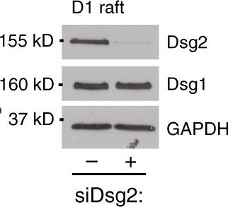 Desmosomal cadherin association with Tctex-1 and cortactin-Arp2/3 drives perijunctional actin polymerization to promote keratinocyte delamination.