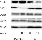 Fig.5.F showing Western Blotting in a Homo sapiens (Human) sample from the publication: Erythropoietin does not activate erythropoietin receptor signaling or lipolytic pathways in human subcutaneous white adipose tissue in vivo.