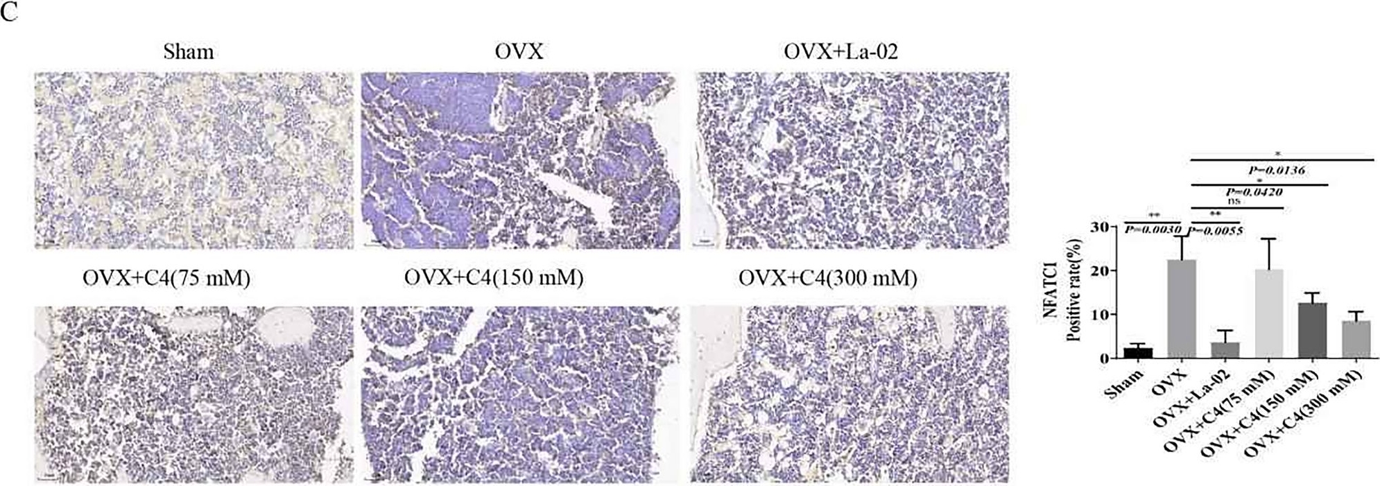 Fig.4.C showing Immunohistochemistry in a Homo sapiens (Human) sample from the publication: Mechanistic study on the alleviation of postmenopausal osteoporosis by Lactobacillus acidophilus through butyrate-mediated inhibition of osteoclast activity.