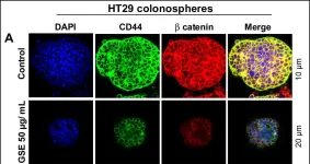 Fig.7.A showing Immunocytochemistry-immunofluorescence from the publication: Functional modification of adipocytes by grape seed extract impairs their pro-tumorigenic signaling on colon cancer stem cells and the daughter cancer cells.