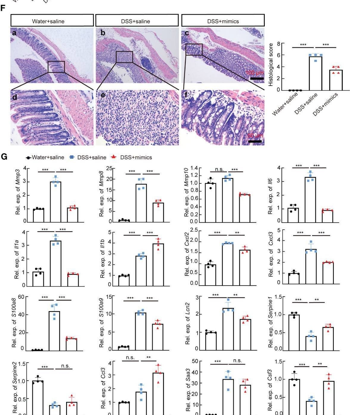Fig.7.F showing Immunohistochemistry in a Mus musculus (House mouse) sample from the publication: MiR-146a alleviates inflammatory bowel disease in mice through systematic regulation of multiple genetic networks.