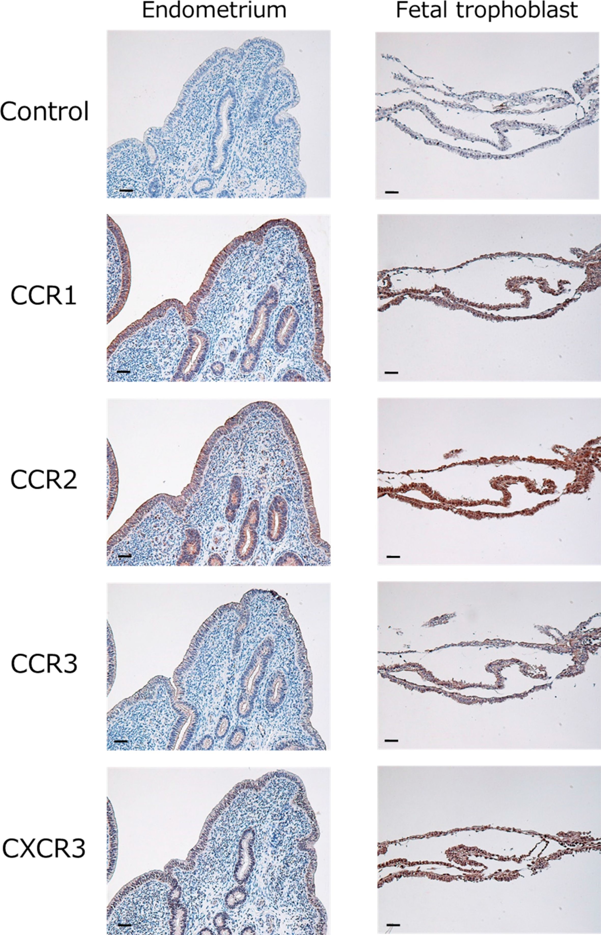 Fig.2.A showing Immunohistochemistry in a Bos taurus (Bovine) sample from the publication: Possible Roles of CC- and CXC-Chemokines in Regulating Bovine Endometrial Function during Early Pregnancy.