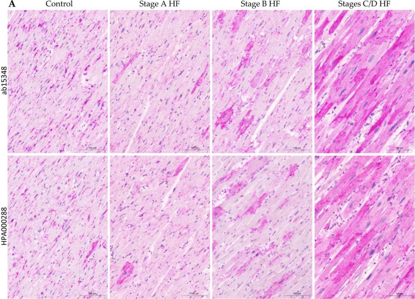 Fig.1.A showing Immunohistochemistry from the publication: Myocardial Angiotensin-Converting Enzyme 2 Protein Expression in Ischemic Heart Failure.