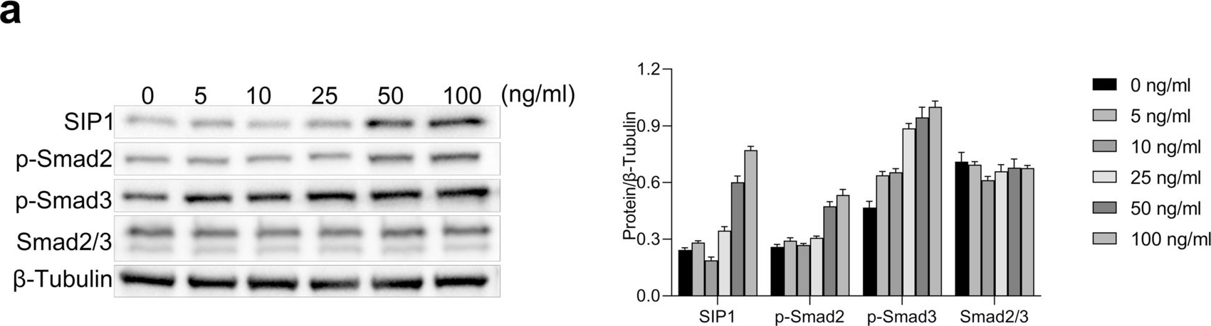 Fig.6.A showing Western Blotting in a Homo sapiens (Human) sample from the publication: Umbilical cord mesenchymal stem cell-derived exosomes inhibits fibrosis in human endometrial stromal cells via miR-140-3p/FOXP1/Smad axis.