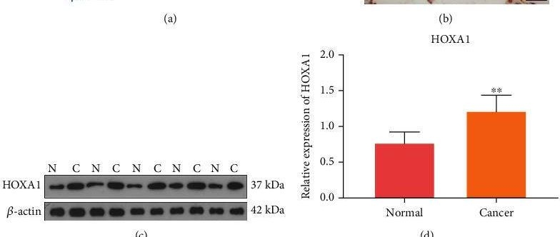 Fig.2.A showing Western Blotting from the publication: Homeobox A1 Facilitates Immune Escape and Alleviates Oxidative Stress in Lung Adenocarcinoma.