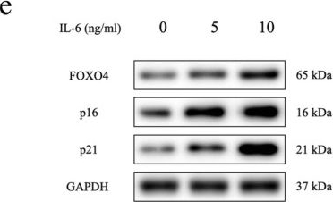 Fig.1.E showing Western Blotting in a Homo sapiens (Human) sample from the publication: 17-β-Estradiol Protects Chondrocytes From Senescence and Ameliorates Osteoarthritis Progression via ERα-AKT-FOXO4 Pathway.