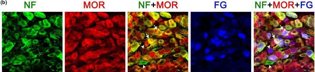 Fig.4.B showing Immunohistochemistry-immunofluorescence from the publication: Apneic response to fentanyl in adult rats: Role of laryngeal afferents.