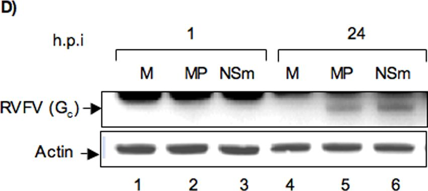 Fig.5.D showing Western Blotting in a Homo sapiens (Human) sample from the publication: Alteration in superoxide dismutase 1 causes oxidative stress and p38 MAPK activation following RVFV infection.