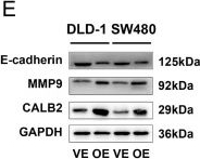 Fig.11.E showing Western Blotting from the publication: A Prognostic Model of Angiogenesis and Neutrophil Extracellular Traps Related Genes Manipulating Tumor Microenvironment in Colon Cancer.