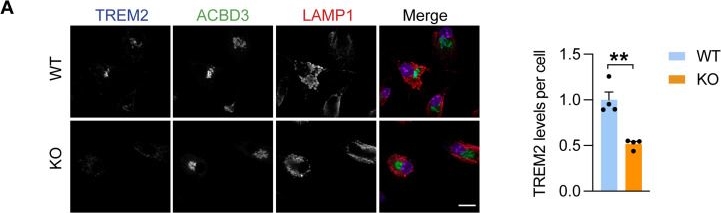Fig.9.A showing Immunocytochemistry-immunofluorescence from the publication: TMEM106B regulates microglial proliferation and survival in response to demyelination.