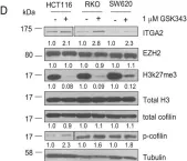 Fig.2.D showing Western Blotting from the publication: EZH2 regulates cofilin activity and colon cancer cell migration by targeting ITGA2 gene.