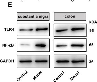 Fig.3.E showing Western Blotting in a Mus musculus (House mouse) sample from the publication: TLR4/NF-κB signaling-mediated neuroinflammation is associated with gut microbiota dysbiosis in a mouse model of Parkinson's disease.