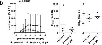 Fig.6.B from the publication: Vasoactivity of Rac GTPase, Cytohesin and Kinase Inhibitors in Renal Interlobar and Coronary Arteries Reveals Shared and Distinct Patterns of Inhibitory Effects in Vascular and Prostate Smooth Muscle Contraction.