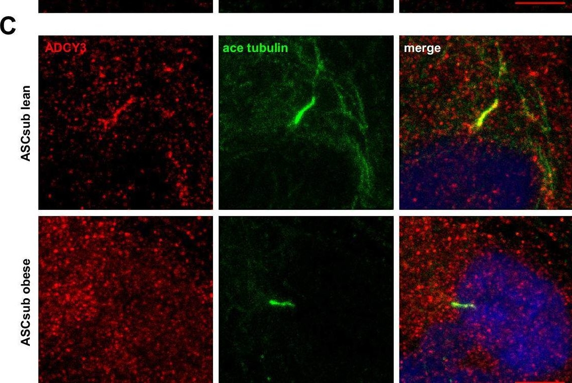 Fig.5.C showing Immunocytochemistry-immunofluorescence in a Homo sapiens (Human) sample from the publication: In-depth analysis of obesity-associated changes in adipose tissue-derived mesenchymal stromal/stem cells and primary cilia function.