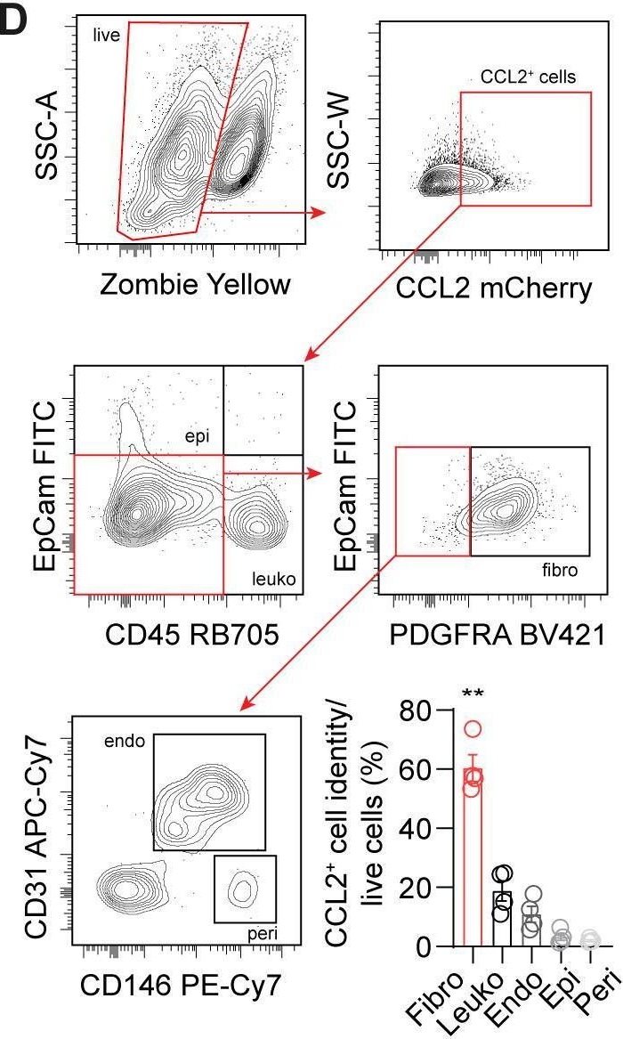 Fig.6.D showing Flow cytometry/Cell sorting from the publication: ICAM1+ gingival fibroblasts modulate periodontal inflammation to mitigate bone loss.