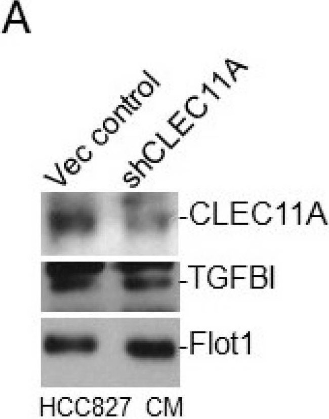 Fig.4.A showing Western Blotting in a Homo sapiens (Human) sample from the publication: EGFR Mutation-Harboring Lung Cancer Cells Produce CLEC11A with Endothelial Trophic and Tumor-Promoting Activities.