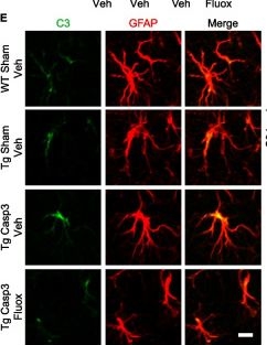 Fig.9.E showing Immunocytochemistry-immunofluorescence in a Mus musculus (House mouse) sample from the publication: Midbrain degeneration triggers astrocyte reactivity and tau pathology in experimental Alzheimer's Disease.