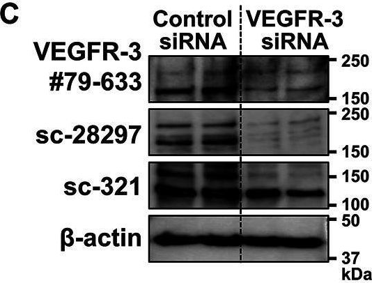 Fig.2.C showing Western Blotting from the publication: MAZ51 Blocks the Tumor Growth of Prostate Cancer by Inhibiting Vascular Endothelial Growth Factor Receptor 3.