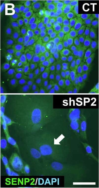 Fig.2.B showing Immunocytochemistry-immunofluorescence from the publication: Sumo-regulatory SENP2 controls the homeostatic squamous mitosis-differentiation checkpoint.