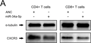 Fig.5.A showing Western Blotting from the publication: Wrinkle in the plan: miR-34a-5p impacts chemokine signaling by modulating CXCL10/CXCL11/CXCR3-axis in CD4+, CD8+ T cells, and M1 macrophages.
