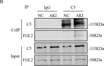 Fig.7.B showing Western Blotting in a Mus musculus (House mouse) sample from the publication: Fibrinogen-like protein 2-complement C3 interaction exacerbates tubular inflammation in acute kidney injury by elevating complement C3a levels.