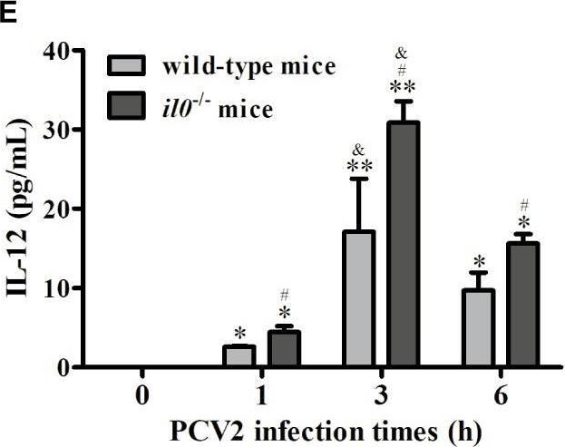 Fig.1.E showing Enzyme-linked immunosorbent assay from the publication: Interleukin-10 Promotes Porcine Circovirus Type 2 Persistent Infection in Mice and Aggravates the Tissue Lesions by Suppression of T Cell Infiltration.