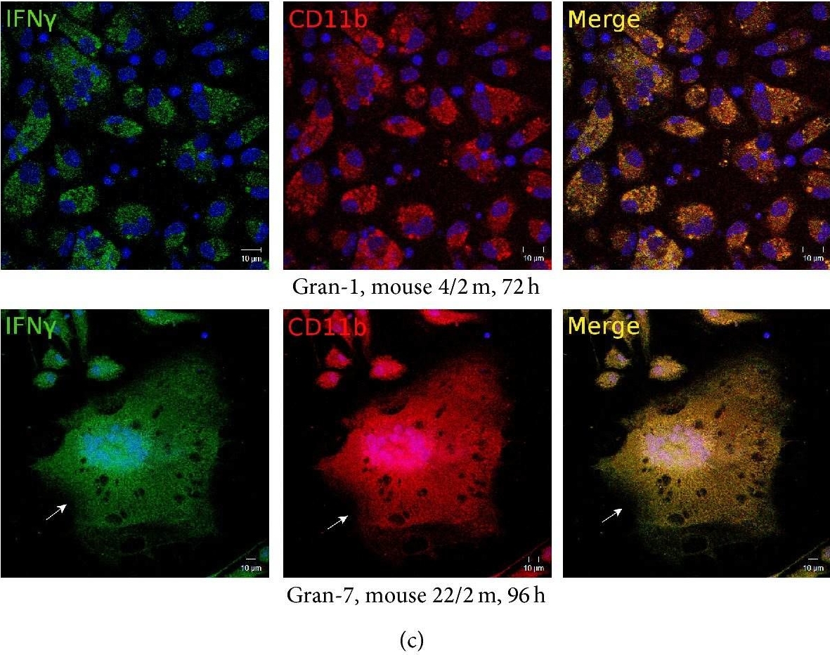 Fig.6.C showing Immunocytochemistry-immunofluorescence in a Mus musculus (House mouse) sample from the publication: Differences between Mycobacterium-Host Cell Relationships in Latent Tuberculous Infection of Mice Ex Vivo and Mycobacterial Infection of Mouse Cells In Vitro.
