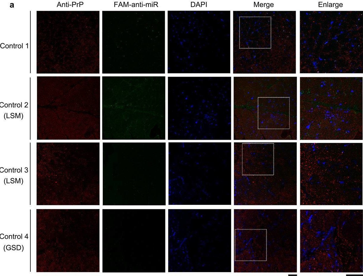 Fig.2.A showing Immunocytochemistry-immunofluorescence from the publication: Excess PrPC inhibits muscle cell differentiation via miRNA-enhanced liquid-liquid phase separation implicated in myopathy.