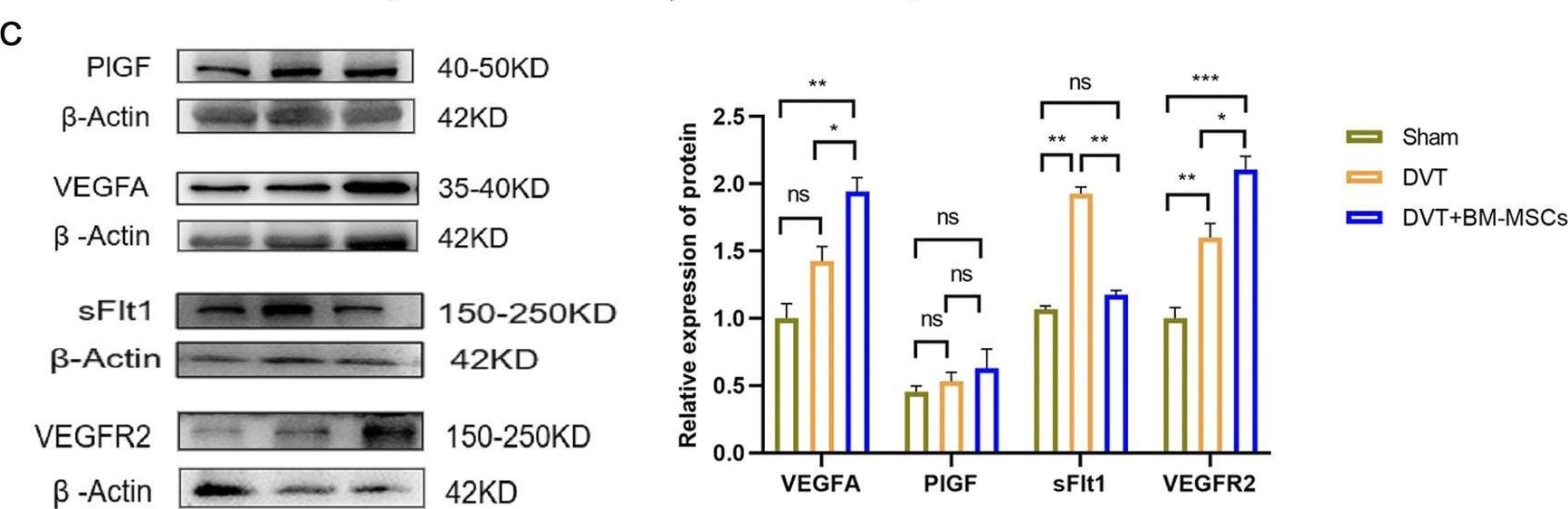 Fig.7.C showing Western Blotting from the publication: Amelioration of pregnancy outcomes in a pregnant rat model with deep venous thrombosis following the transplantation of bone marrow mesenchymal stem cells.
