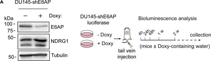 Fig.4.A showing Western Blotting in a Homo sapiens (Human) sample from the publication: E6AP Promotes a Metastatic Phenotype in Prostate Cancer.